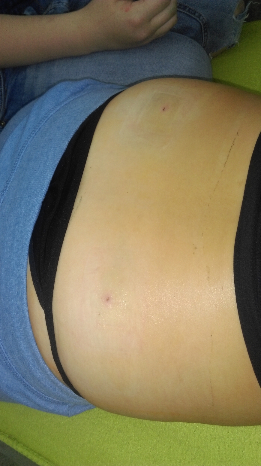 'Neue Lebensretterin aus Krumbach für 23 jährigen Brasilianer gefunden!'-Bild-7