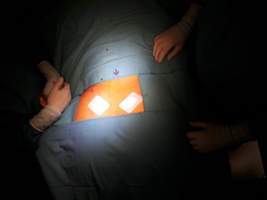 'Vorarlbergerin spendet Knochenmark für kleines Kind aus Mitteleuropa'-Bild-2