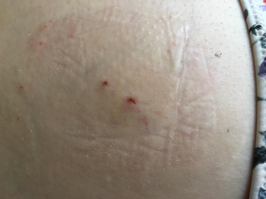 'Vorarlbergerin spendet Knochenmark für kleines Kind aus Mitteleuropa'-Bild-5